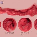 6.1kg【リアル肌質感】TPE製 トルソードール ナチュラルスキン 半身タイプ